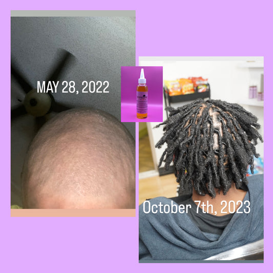 Scalp Therapy Hair Oil